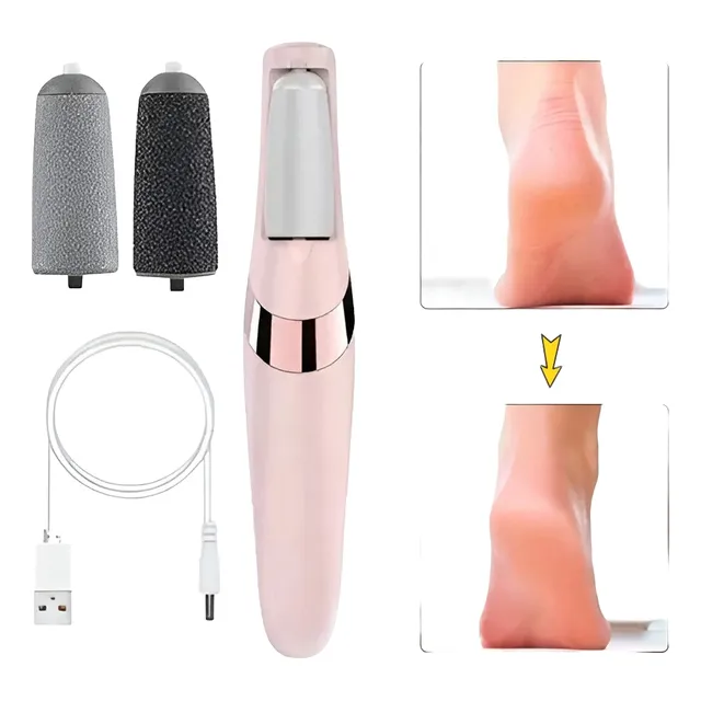 Aparelho Lixa Pés Elétrico Esfoliante Removedor De Calos Usb 110v/220v Aparelho Lixa Pés Elétrico Esfoliante Removedor De Calos Usb 110v/220v
